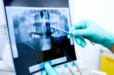 Dental xray-jpg